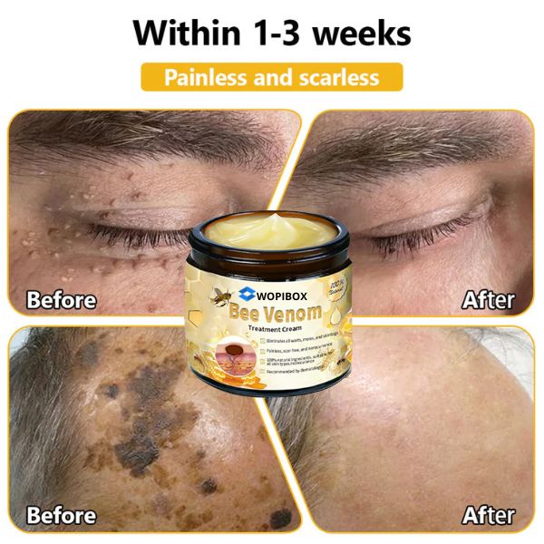 Bee Venom Skin Treatment Cream (AAD Recommended👨‍⚕️)